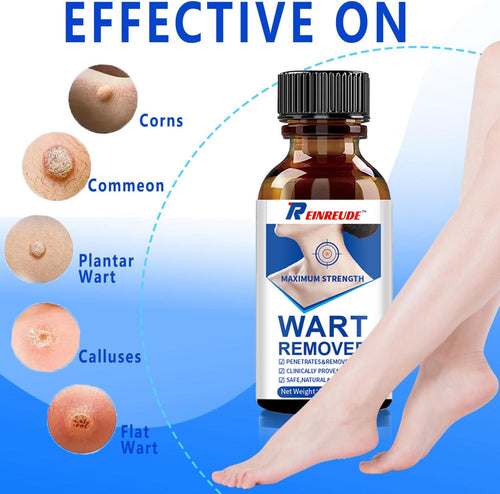 Skin Tag Removal Kit - 30ml at-Home Skin Tag Remover - 17% Salicylic Acid Wart Remover Freeze Off, Fast-Acting on Plantar Warts, Common Wart, Flat Wart, Corns and Genital Warts(-1
