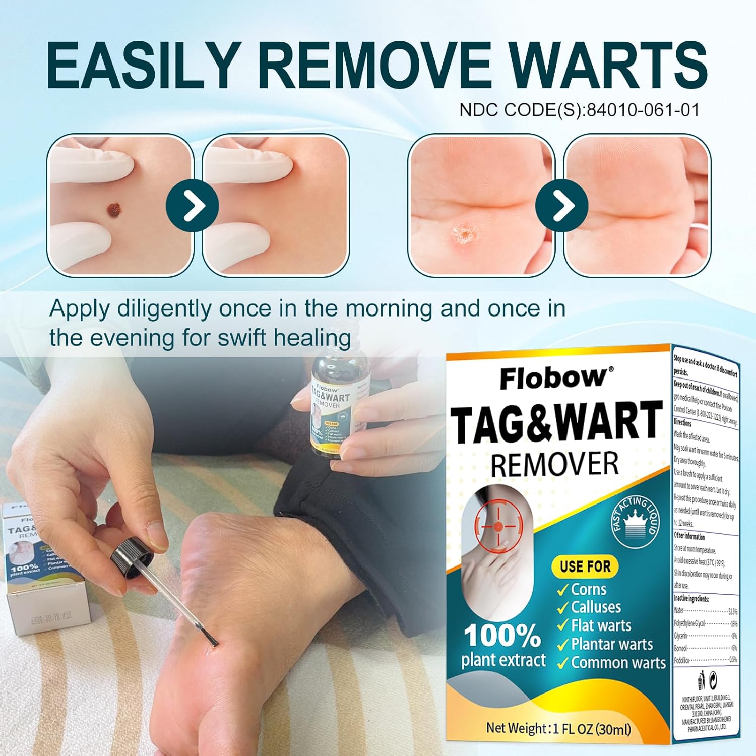 Skin Tag Removal Kit - Fast-Acting Wart Liquid with 17% Salicylic Acid for Men and Women, Targets Plantar Warts, Flat Warts, Common Warts, Age Spots, Corns, and H-Warts (30ml)