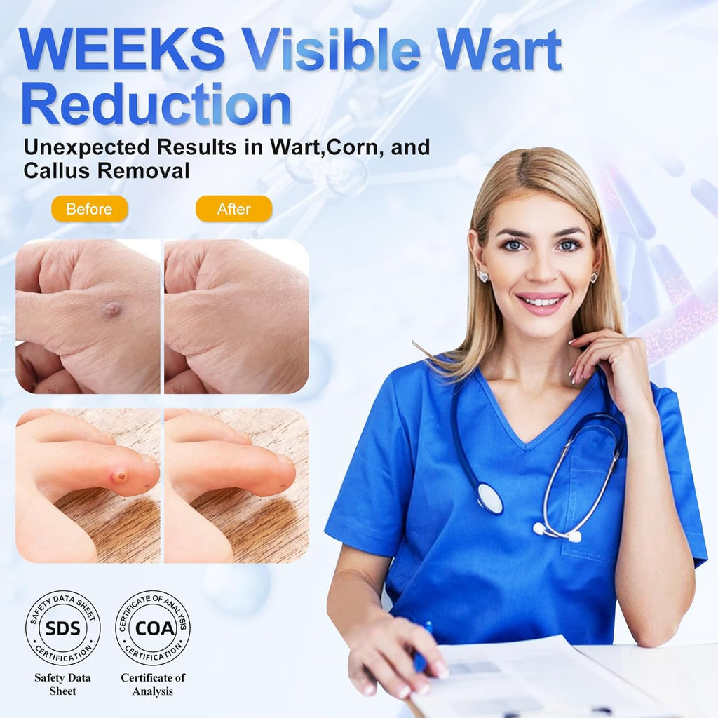 Wart Remover Liquid 5% Salicylic Acid Wart Freeze Off Wart Removal,Wart Remover Freeze Off for Genital,H Wa rt,Common,Flat, Corn, Callus, Plantar Wa rt Remover on Feet,H