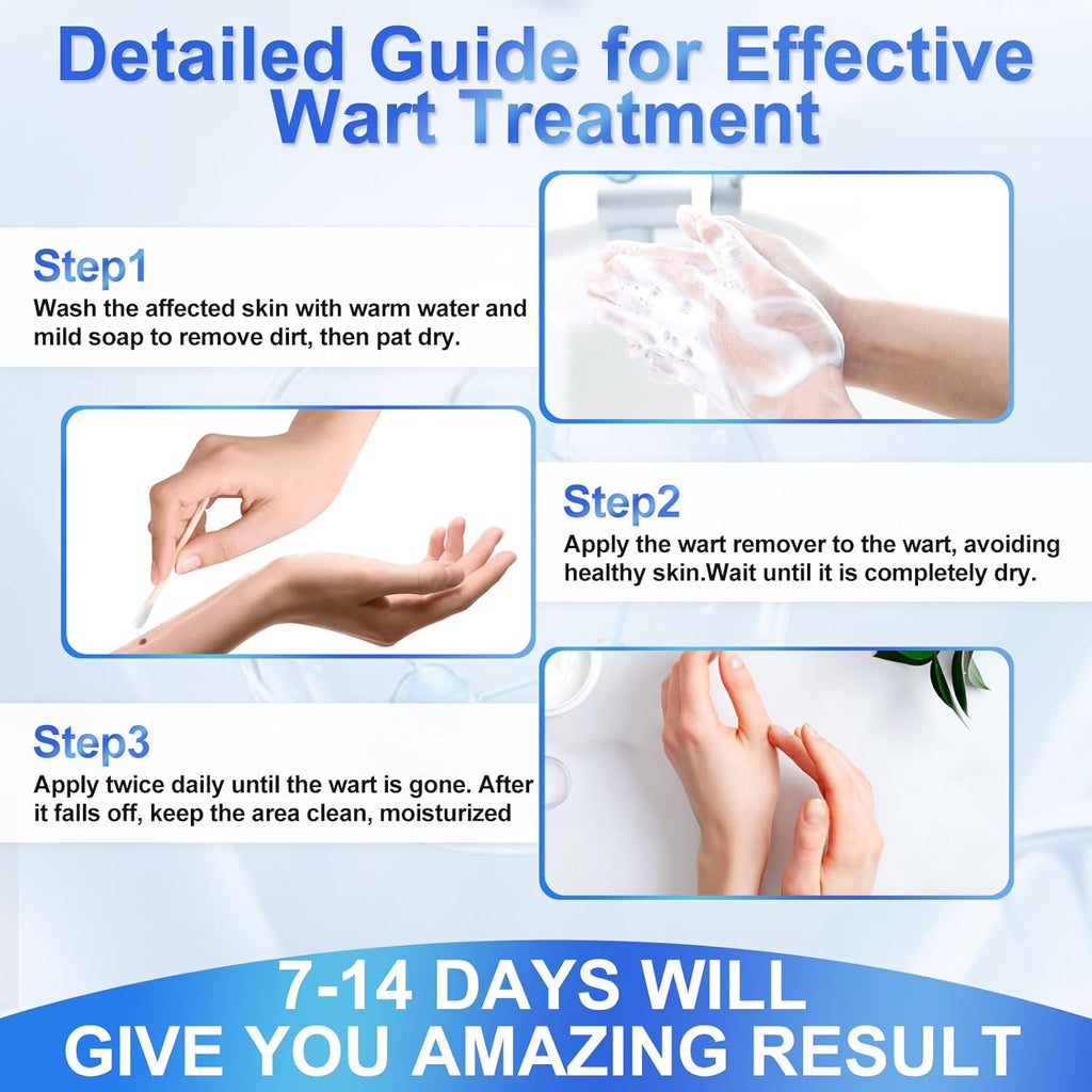 Wart Remover Liquid 5% Salicylic Acid Wart Freeze Off Wart Removal,Wart Remover Freeze Off for Genital,H Wa rt,Common,Flat, Corn, Callus, Plantar Wa rt Remover on Feet,H