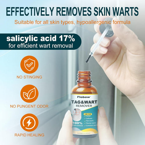 Skin Tag Removal Kit - Fast-Acting Wart Liquid with 17% Salicylic Acid for Men and Women, Targets Plantar Warts, Flat Warts, Common Warts, Age Spots, Corns, and H-Warts (30ml)